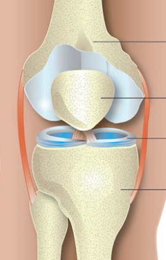 Arthroscopic Meniscal Repairs